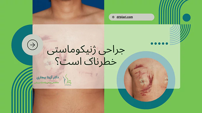 جراحی ژنیکوماستی خطرناک است؟