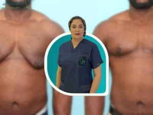بهترین جراح ژنیکوماستی