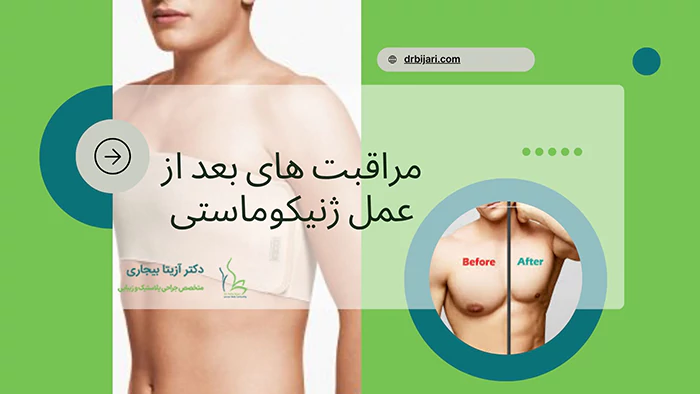 مراقبت بعد از جزاحی ژنیکوماستی