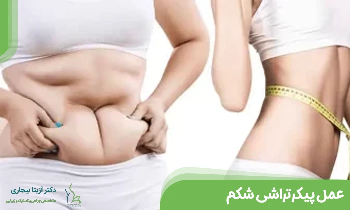 جراحی پیکر تراشی