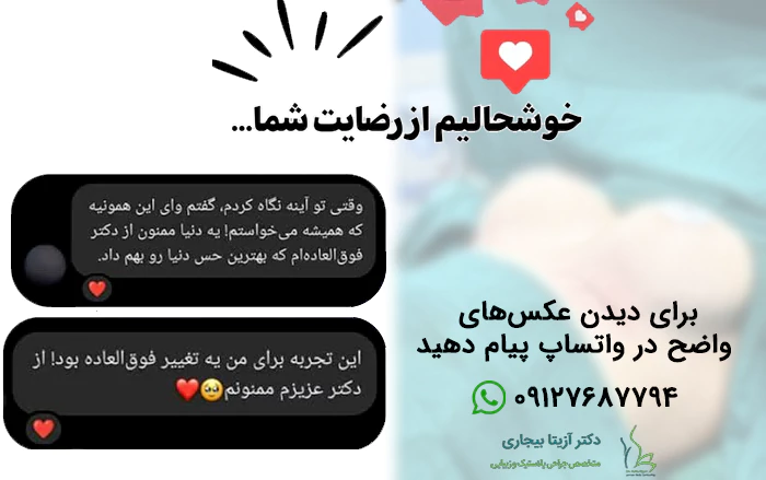 رضایت از پروتز سنه