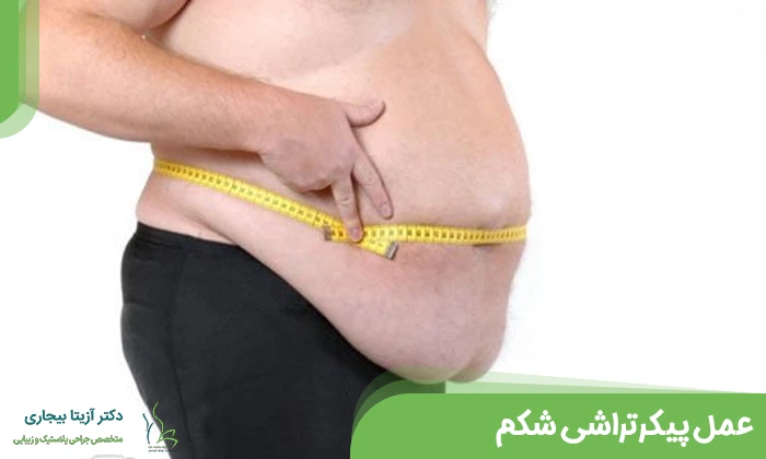 عمل پیکرتراشی شکم
