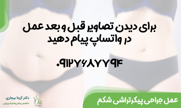 نمونه عمل پیکرتراشی