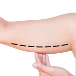 پیکر تراشی بازو