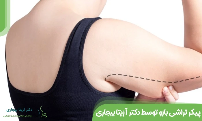 پیکر تراشی بازو توسط دکتر آزیتا بیجاری