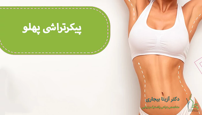 پیکر تراشی پهلو چیست