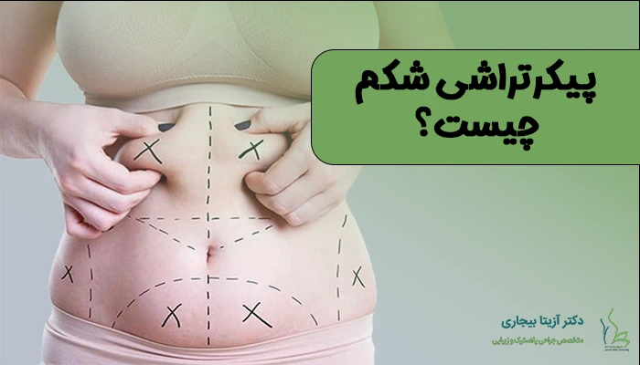 پیکرتراشی شکم چیست