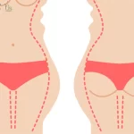 پیکرتراشی پهلو