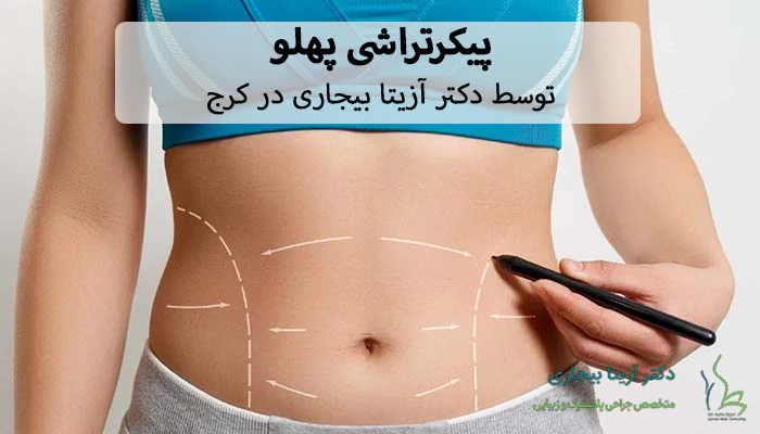 پیکرتراشی پهلو دکتر بیجاری