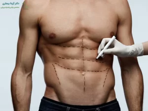 پیکرتراشی برای مردان