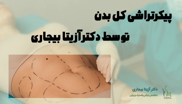 پیکرتراشی کل بدن توسط دکتر بیجاری