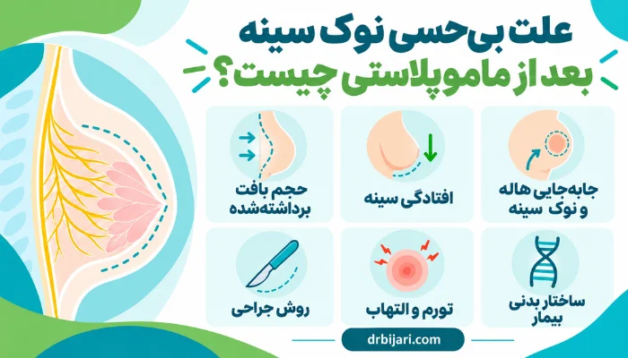 علتهای بیحسی نوک سینه بعد از ماموپلاستی شامل حجم بافت، افتادگی سینه و روش جراحی