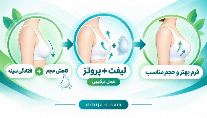 اینفوگرافی لیفت سینه با پروتز برای افرادی با افتادگی سینه و کاهش حجم