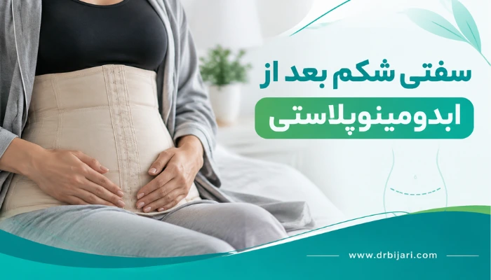 سفتی شکم بعد از ابدومینوپلاستی