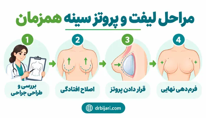 مراحل لیفت و پروتز سینه همزمان از طراحی جراحی تا قرار دادن پروتز و فرم دهی