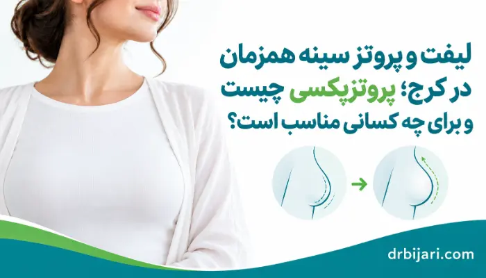 لیفت و پروتز سینه همزمان در کرج برای اصلاح افتادگی و افزایش حجم سینه